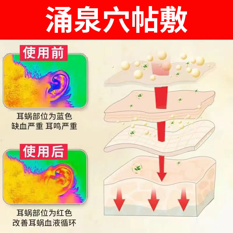 【618专享】广药白云山耳康耳鸣贴10贴/盒*5盒