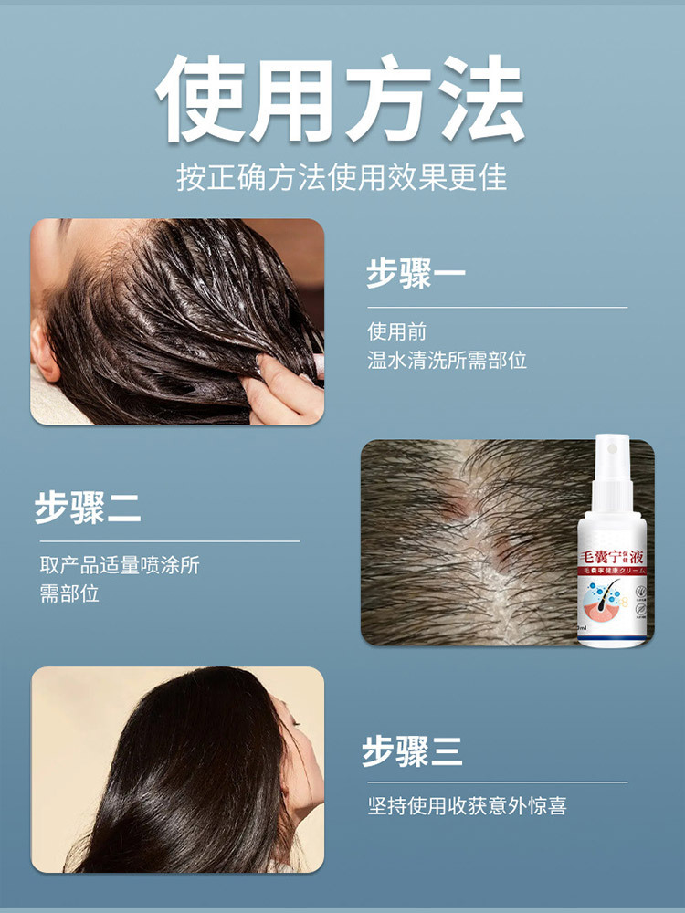 毛囊宁保健液30ml*6瓶头皮止痒背部角质清洁