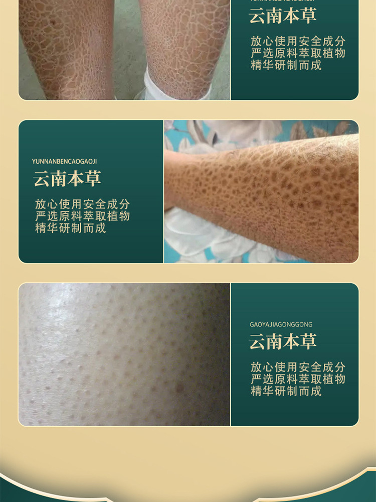 妙德邦·云南本草鱼鳞蛇皮霜30g*3盒滋润皮肤毛囊清膏霜
