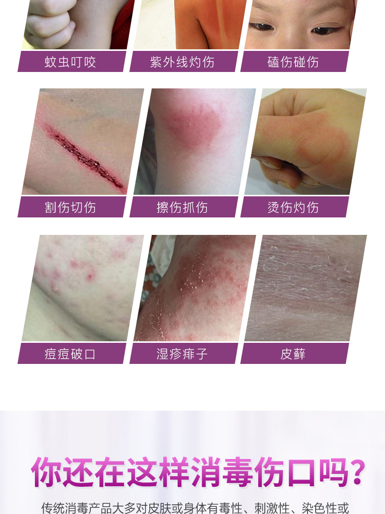 【秒】圣净露皮肤伤口护理250ml*1瓶
