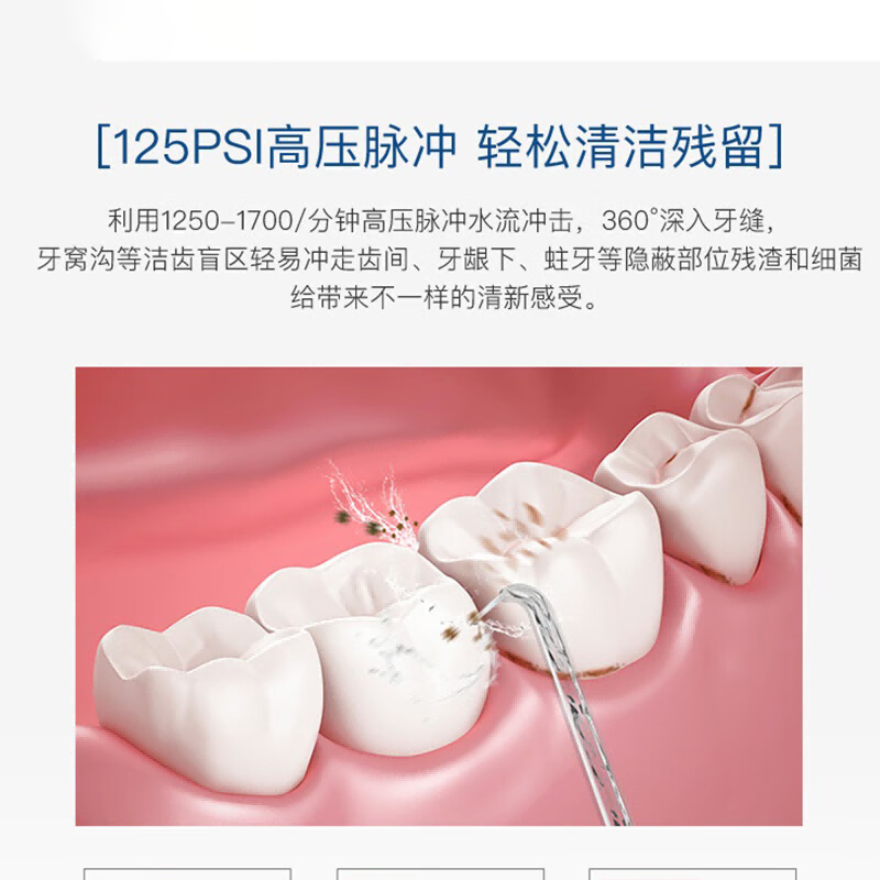 艾优Cf8-1高频脉冲洗牙器 白色