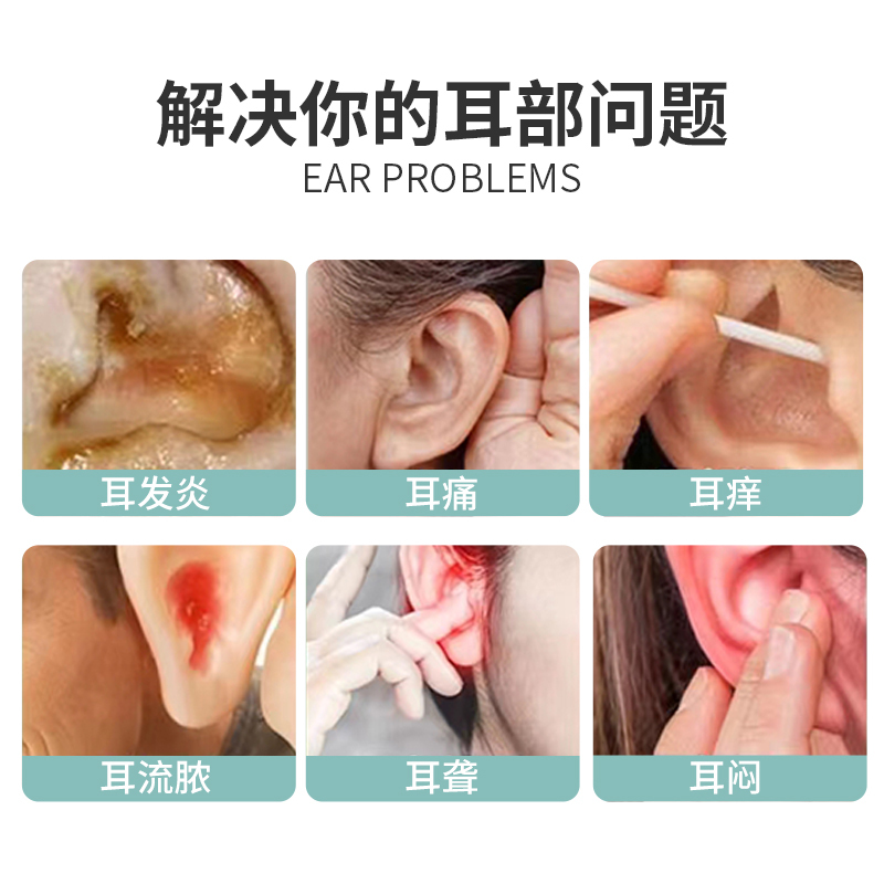 2瓶修正液体敷料（耳部型）（一类器械）·耳炎耳鸣听力下降专用