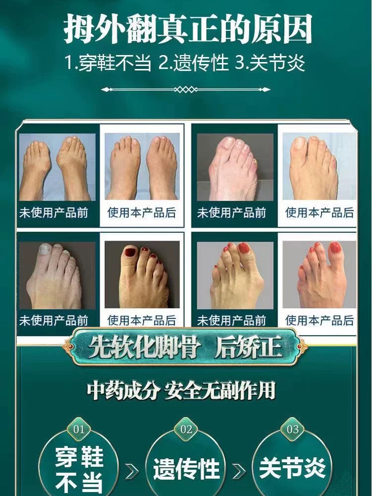 骞氏艾草关节拇外翻艾草贴 8贴/盒*8盒